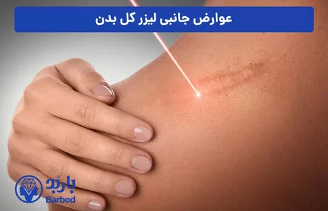 چگونه بهترین مرکز لیزر فول بادی را پیدا کنیم؟