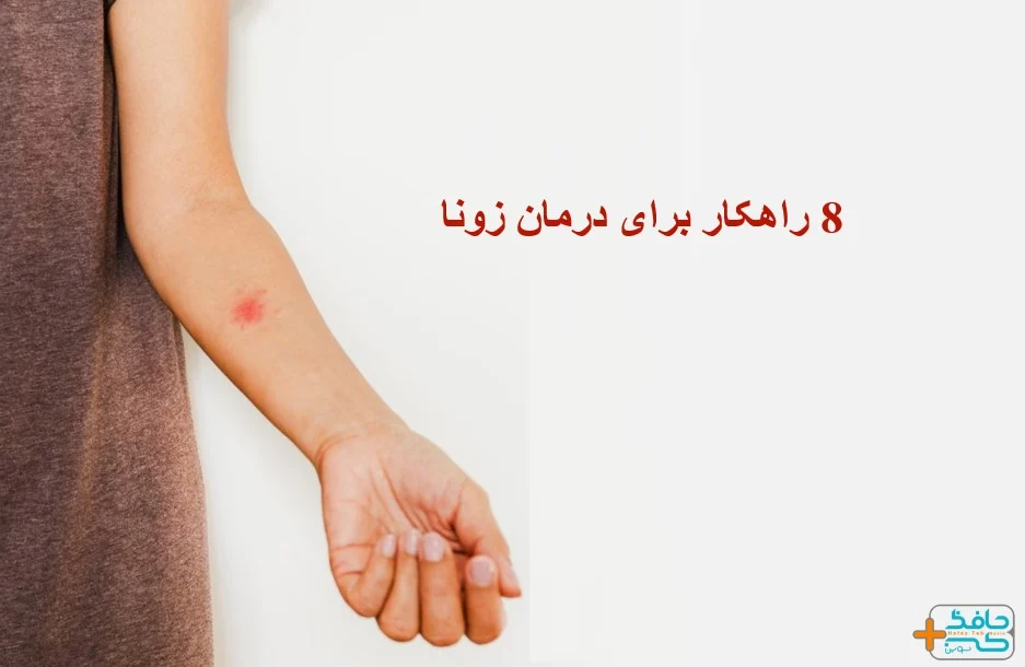 8 راهکار برای درمان زونا