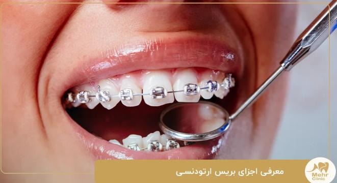 دندان پزشکی | تهران کلینیک دندانپزشکی در شریعتی تهران؛ ارتودنسی دندان با جدیدترین متدها برای لبخندی زیبا و ماندگار