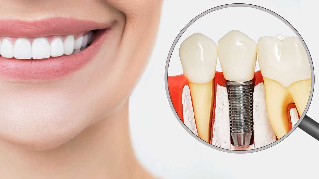 هر چند وقت یکبار باید به دندانپزشک مراجعه کنیم؟ بررسی علمی و توصیه متخصصان